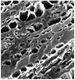 The pore structure of activated carbon